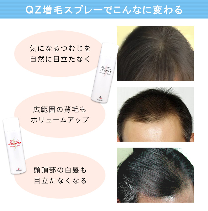 QZ増毛スプレーでこんなに変わる